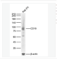 Anti‑CD19 Antibody, Recombinant Rabbit Monoclonal, High Affinity, for WB/IHC/FC/ELISA