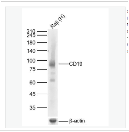 Anti‑CD19 Antibody, Recombinant Rabbit Monoclonal, High Affinity, for WB/IHC/FC/ELISA